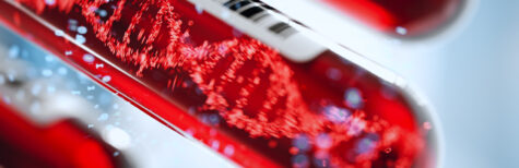 Krebserzeugende Stoffe: Machen Sie den Gefahrstoff-Check